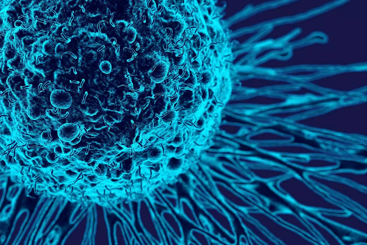 Groundbreaking Method “Starves” Highly-Lethal Cancer Tumors of Energy, Eradicating Them