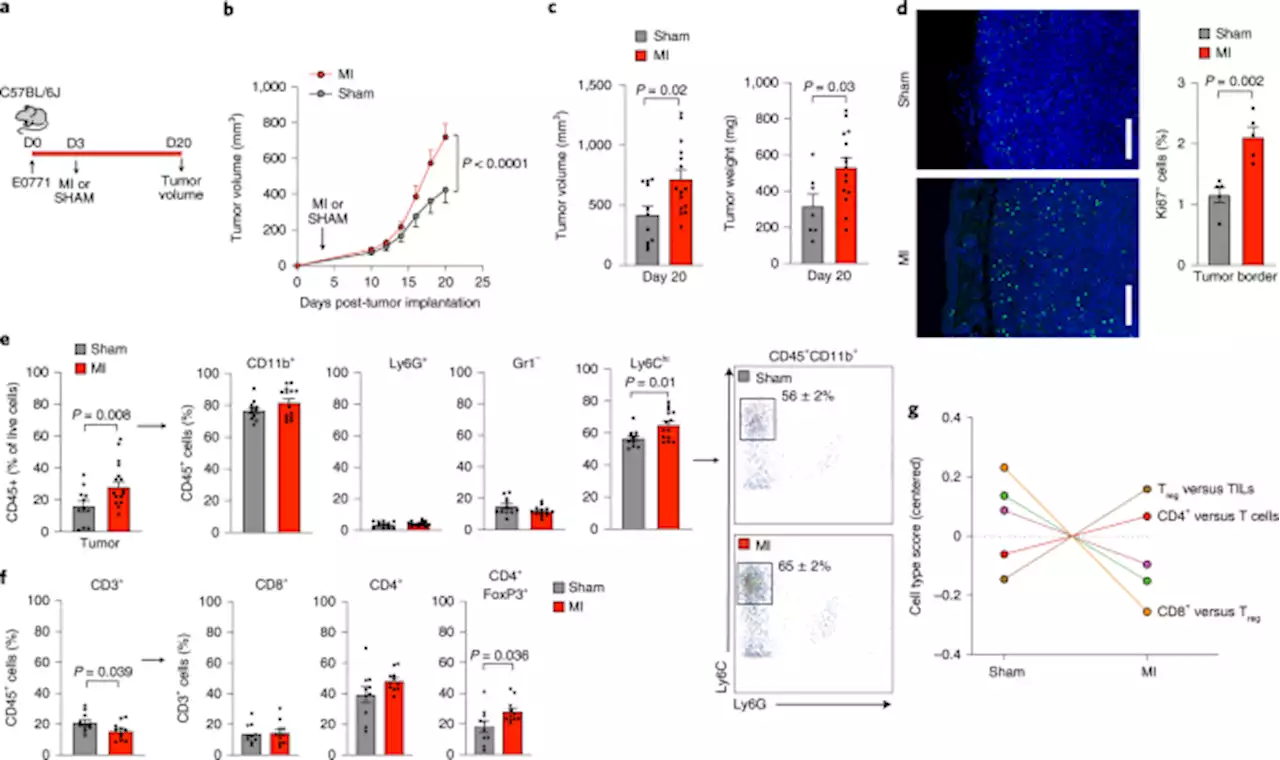 Myocardial infarction accelerates breast cancer via innate immune reprogramming - Nature Medicine