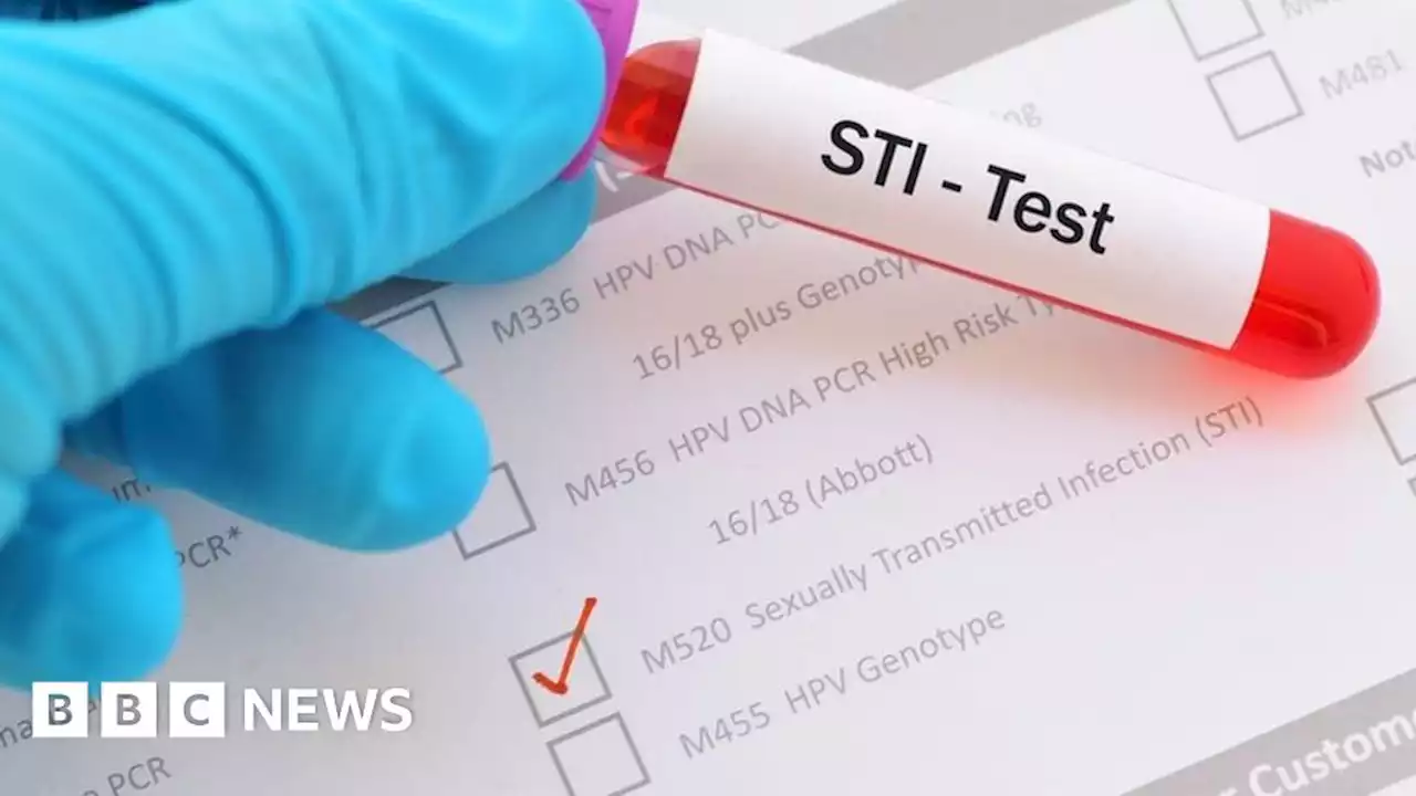 More STI testing needed, says sexual health charity