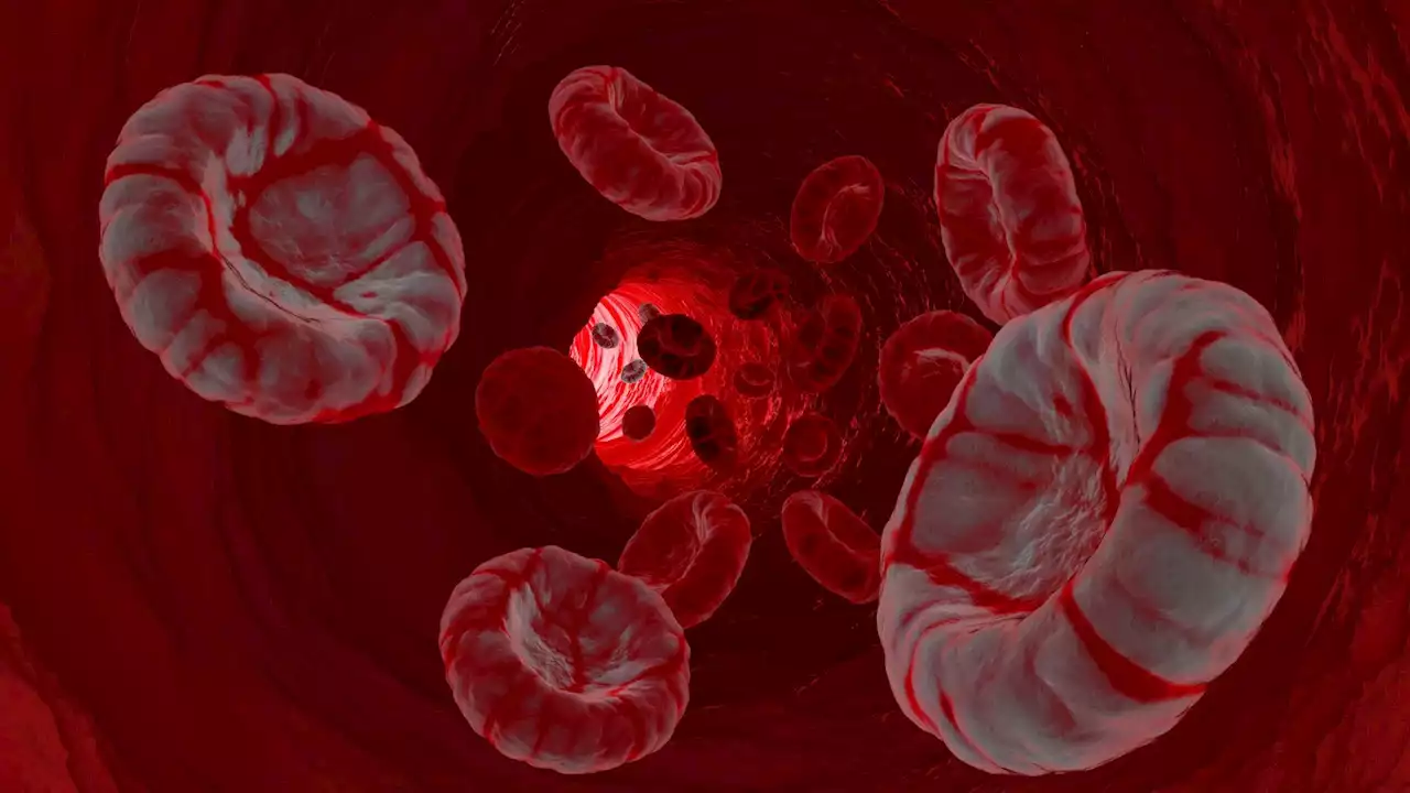 A breakthrough in metastasis could lead to better cancer treatments