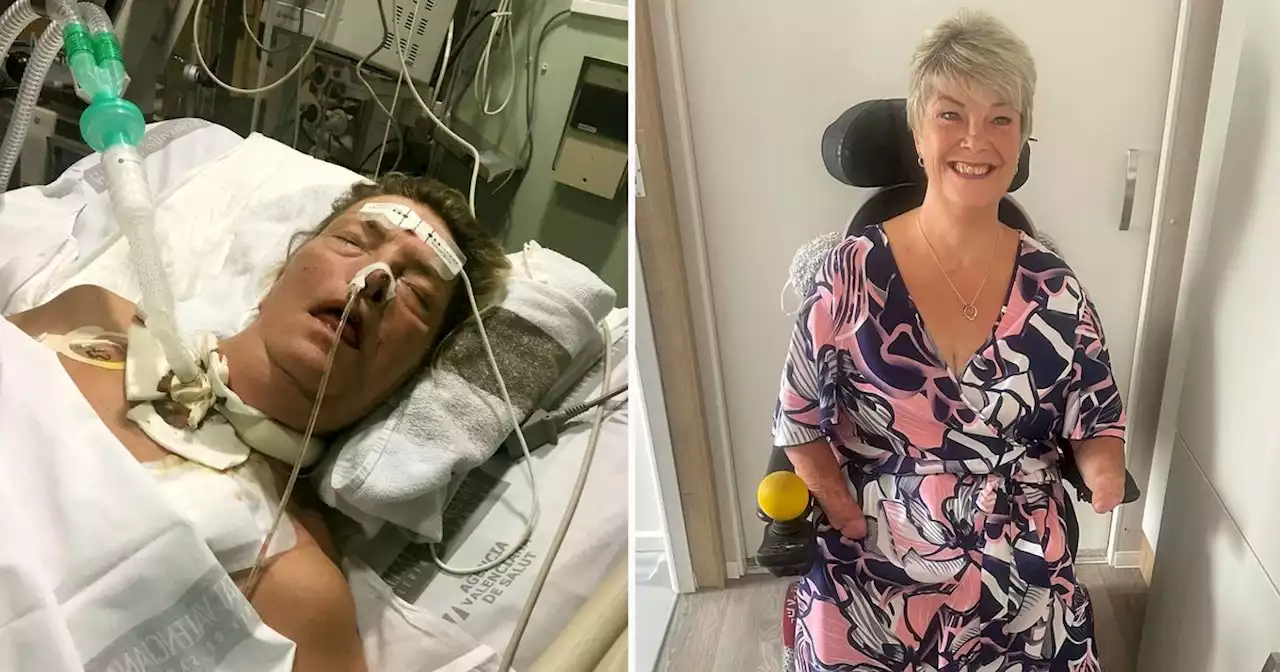 Woman went to hospital with a common infection - but lost all of her limbs