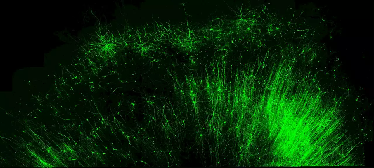 New RNA Tool Can Illuminate Brain Circuits and Edit Specific Cells