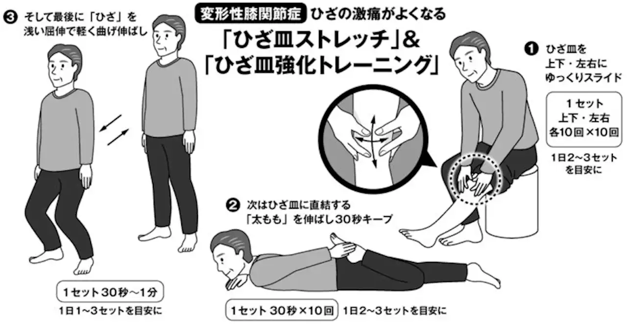 変形性膝関節症は「ひざ皿」をゆらしてケア ひざ痛の進行を止めるポイント - トピックス｜Infoseekニュース