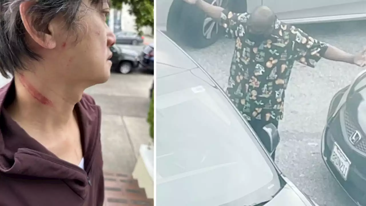 EXCLUSIVE VIDEO: Man punched in the eyes during road rage incident in SF neighborhood