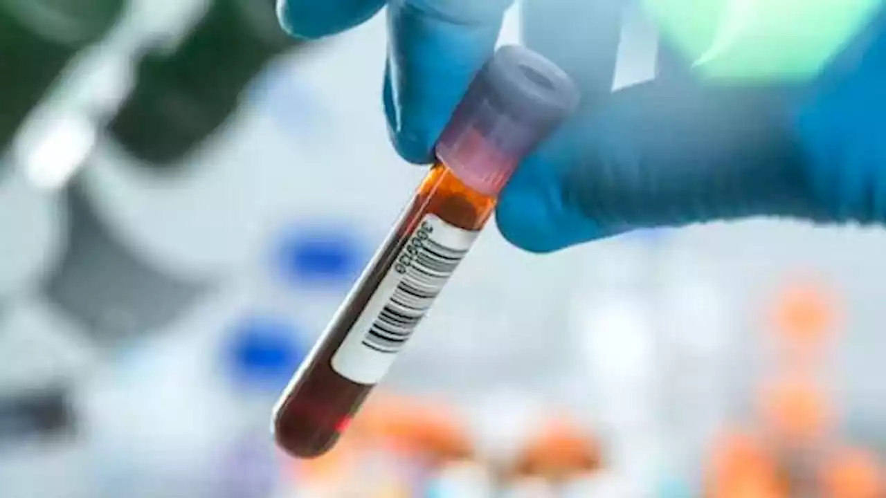 Blood test that screens for multiple cancers at once promises to boost early detection