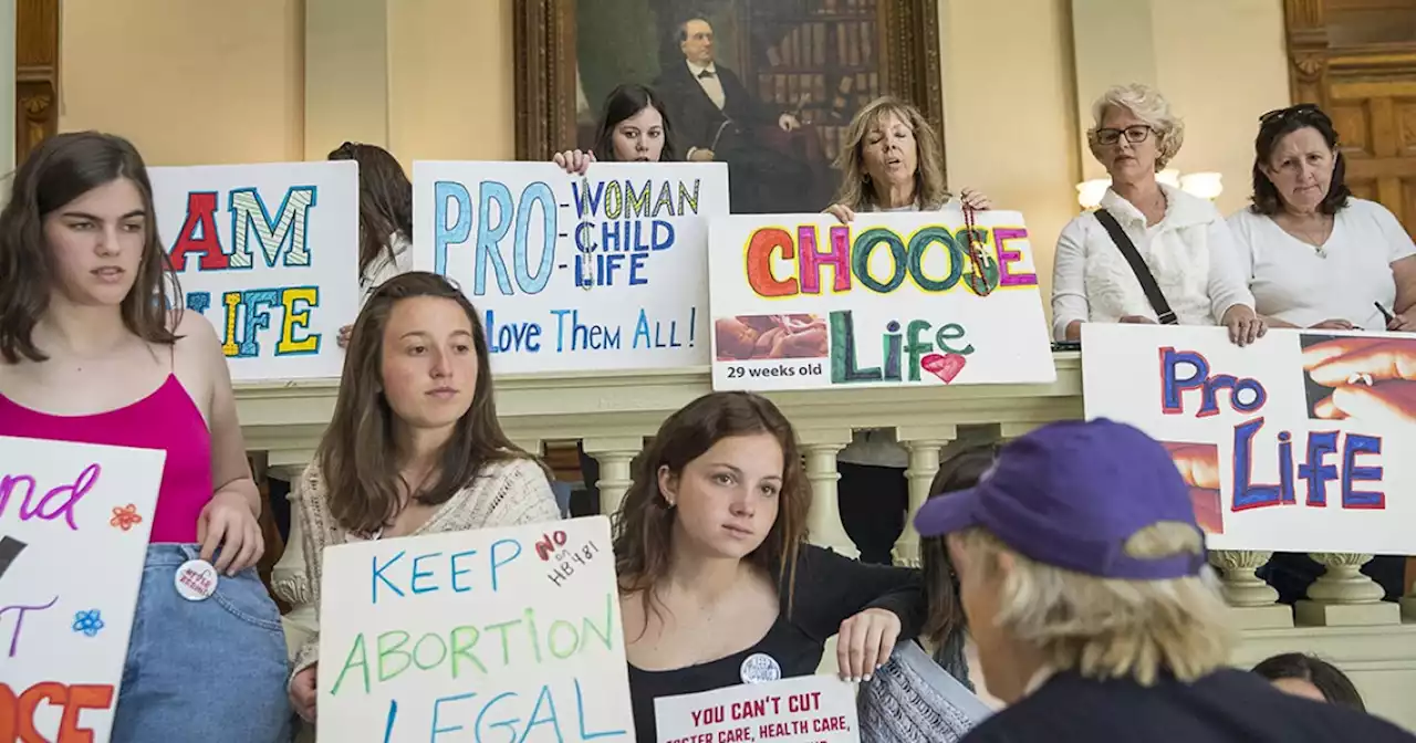 This is not a pro-life society — our task is to make it one