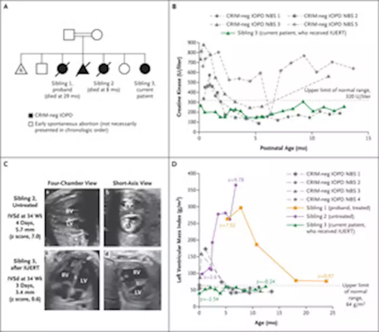 In Utero Enzyme-Replacement Therapy for Infantile-Onset Pompe’s Disease | NEJM