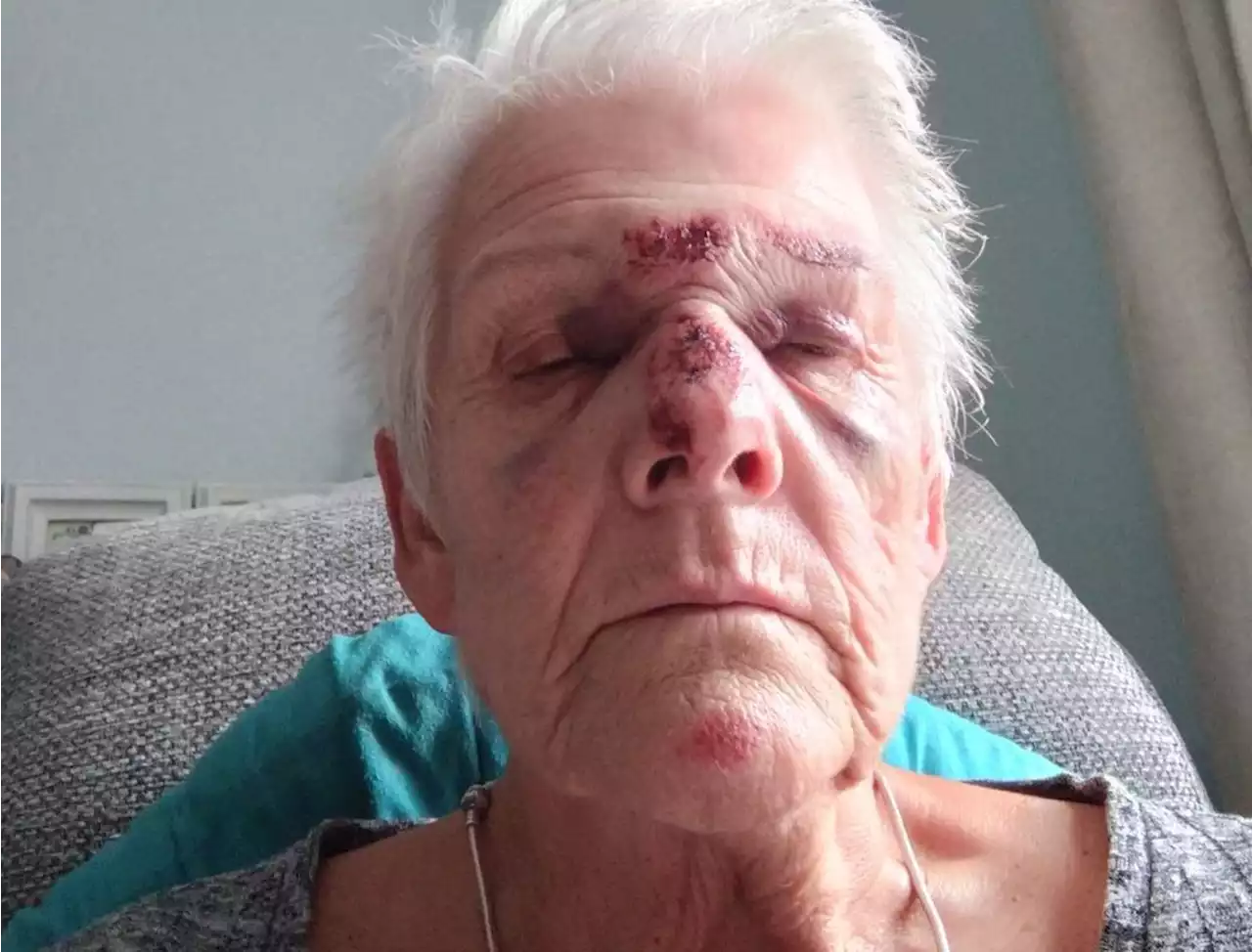 Telford woman spends 15 hours in A&E after suffering broken nose in car park fall