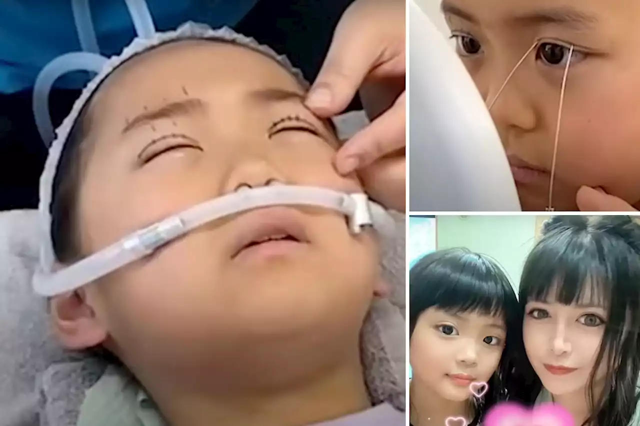 Mom urges 9-year-old daughter to undergo plastic surgery on her eyes to look ‘beautiful’