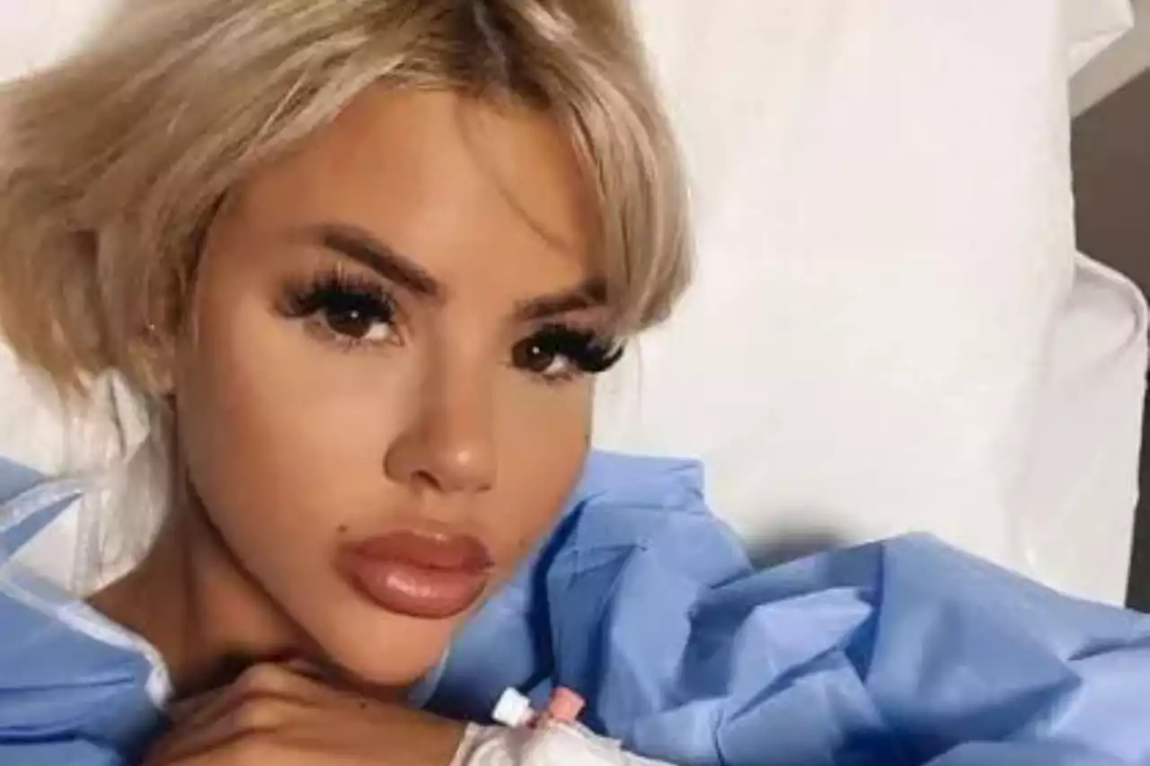 Love Island’s Hannah Elizabeth slams ‘bitter’ trolls over face surgery comments