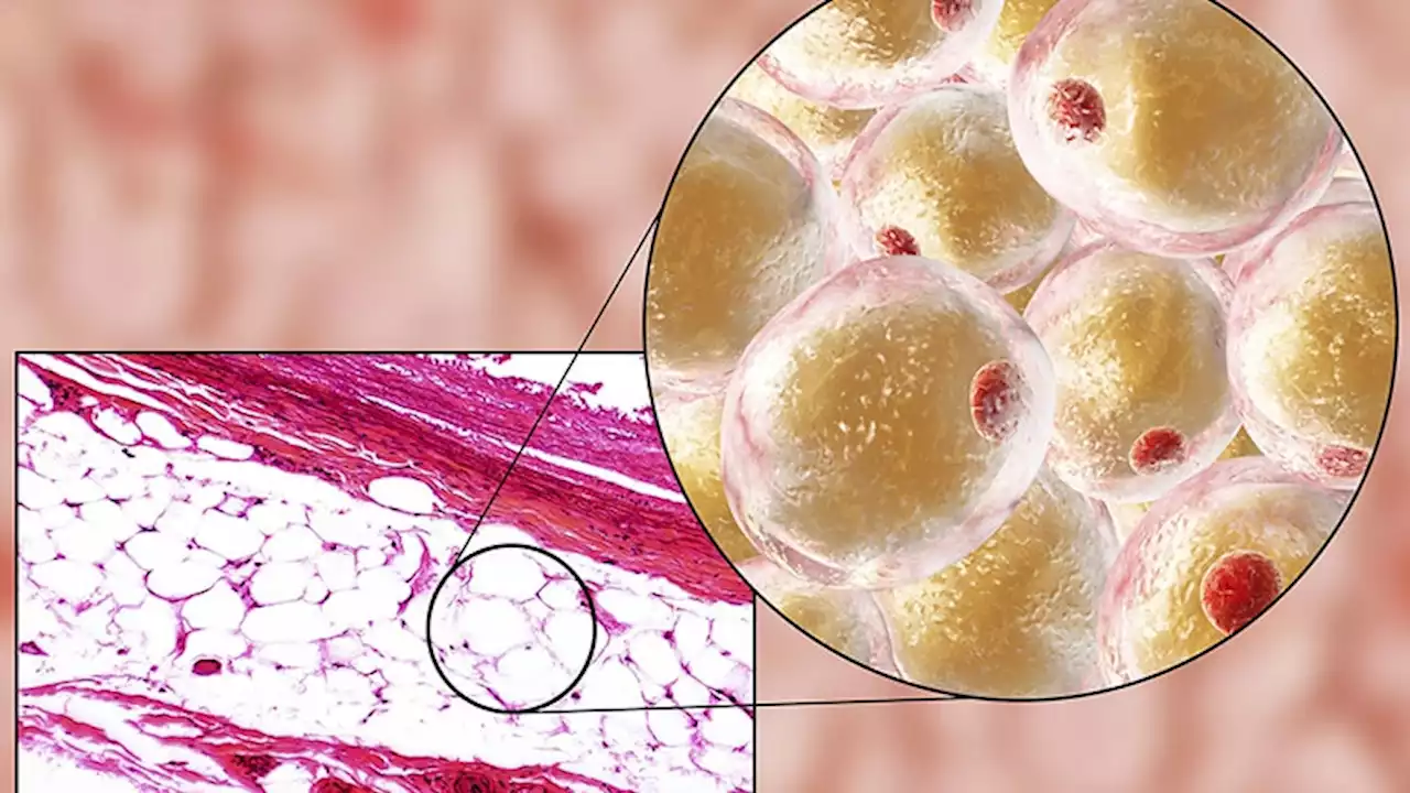 DNA Methylation Implicated in Human Obesity and Diabetes