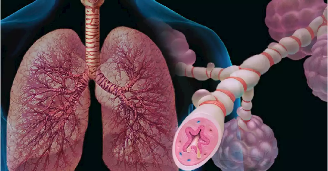 Highlights in Asthma Therapy From CHEST 2022