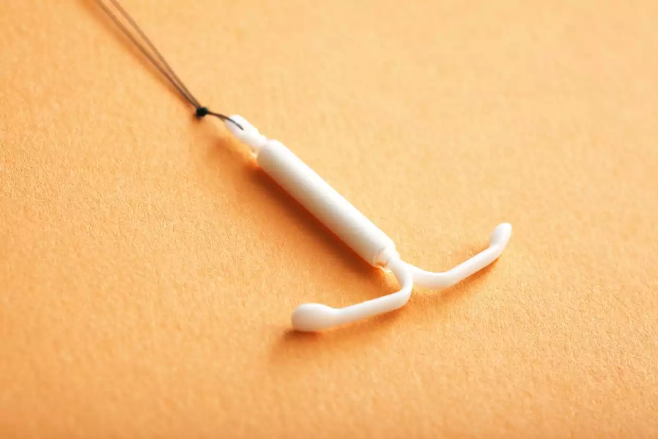 Who Will Remove My IUD?