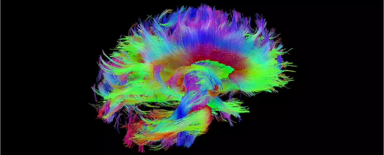 Most Detailed Mapping of Our Brains' Memory Bank Reveals Something Surprising