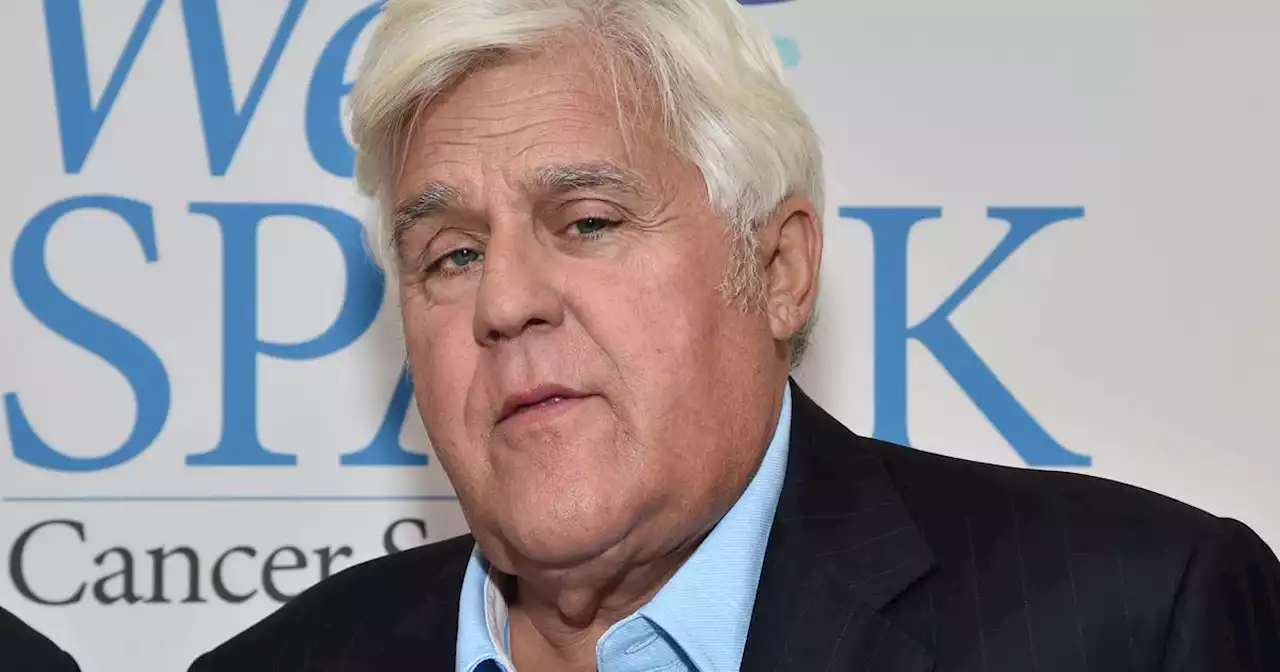 Jay Leno suffers ‘serious’ facial burns after car catches fire