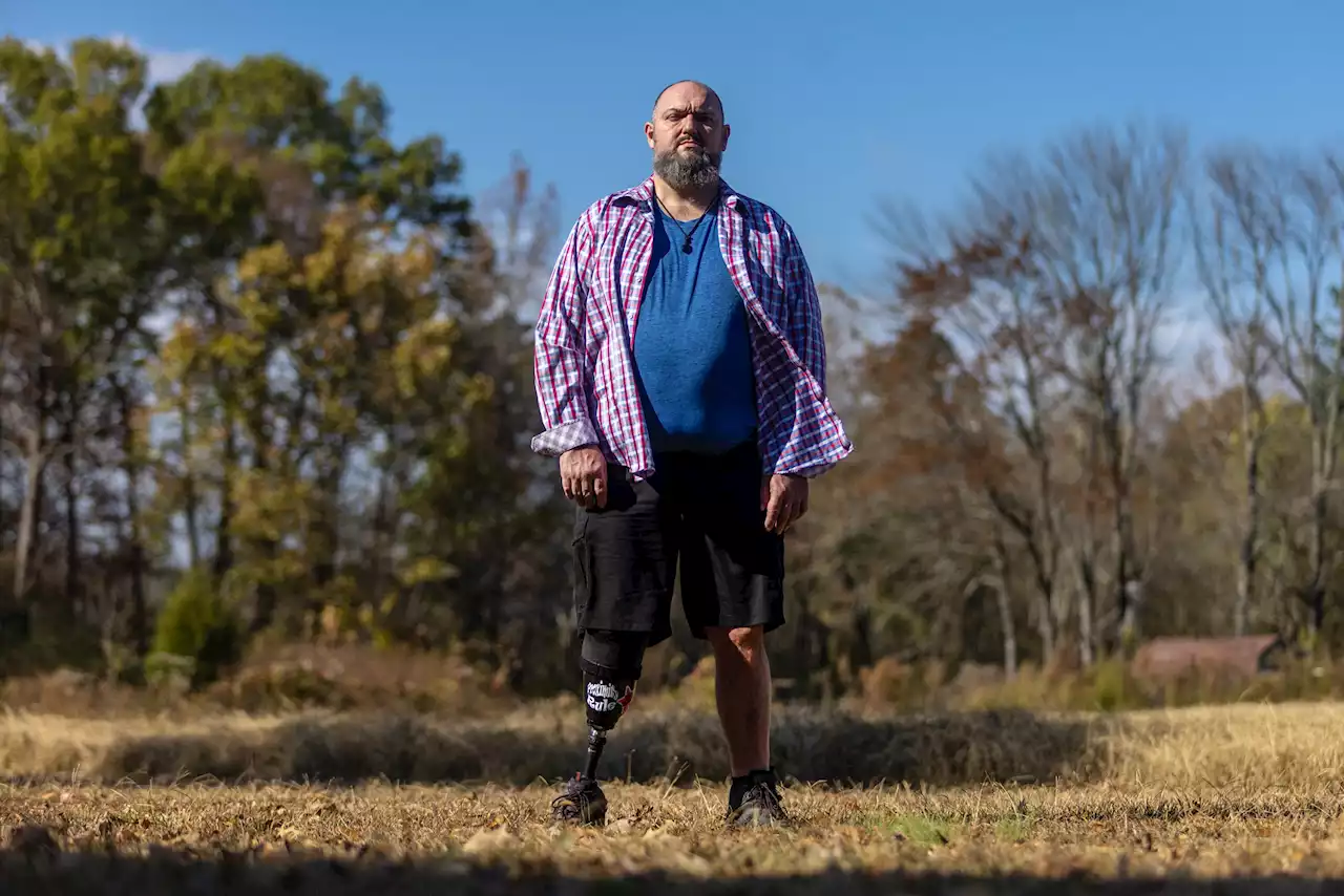 How Medicaid expansion could have saved Tim's leg — and changed his life