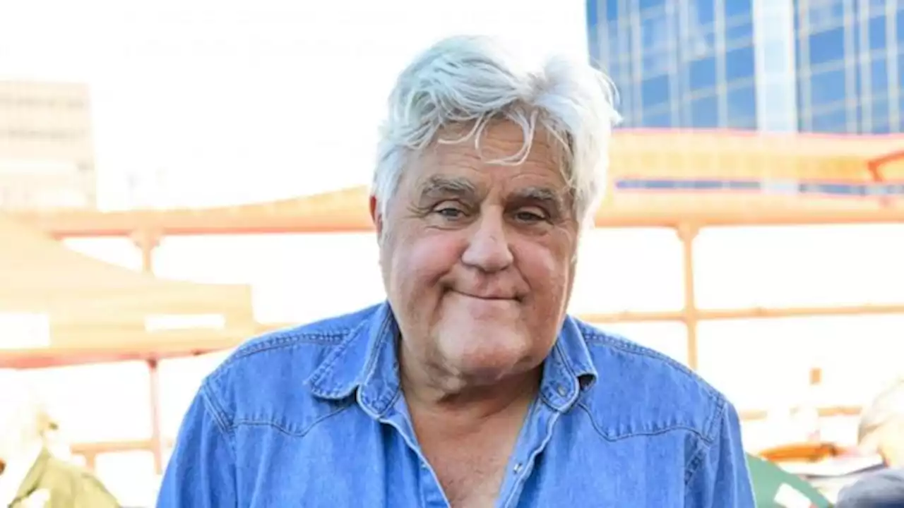 Jay Leno recovering after suffering burns to face, hands in 'gasoline accident'