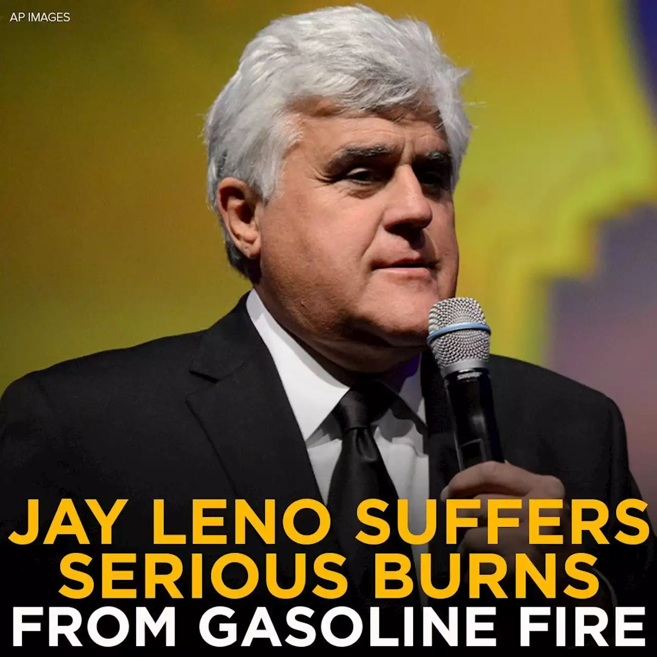 Jay Leno recovering after suffering serious burns from gasoline fire, reports say