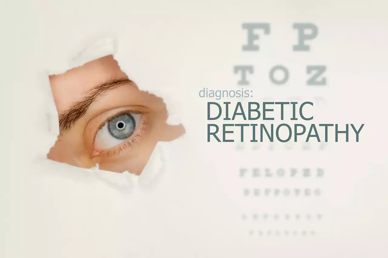 AI For Diabetic Retinopathy Screening Gets U.S. FDA Approval