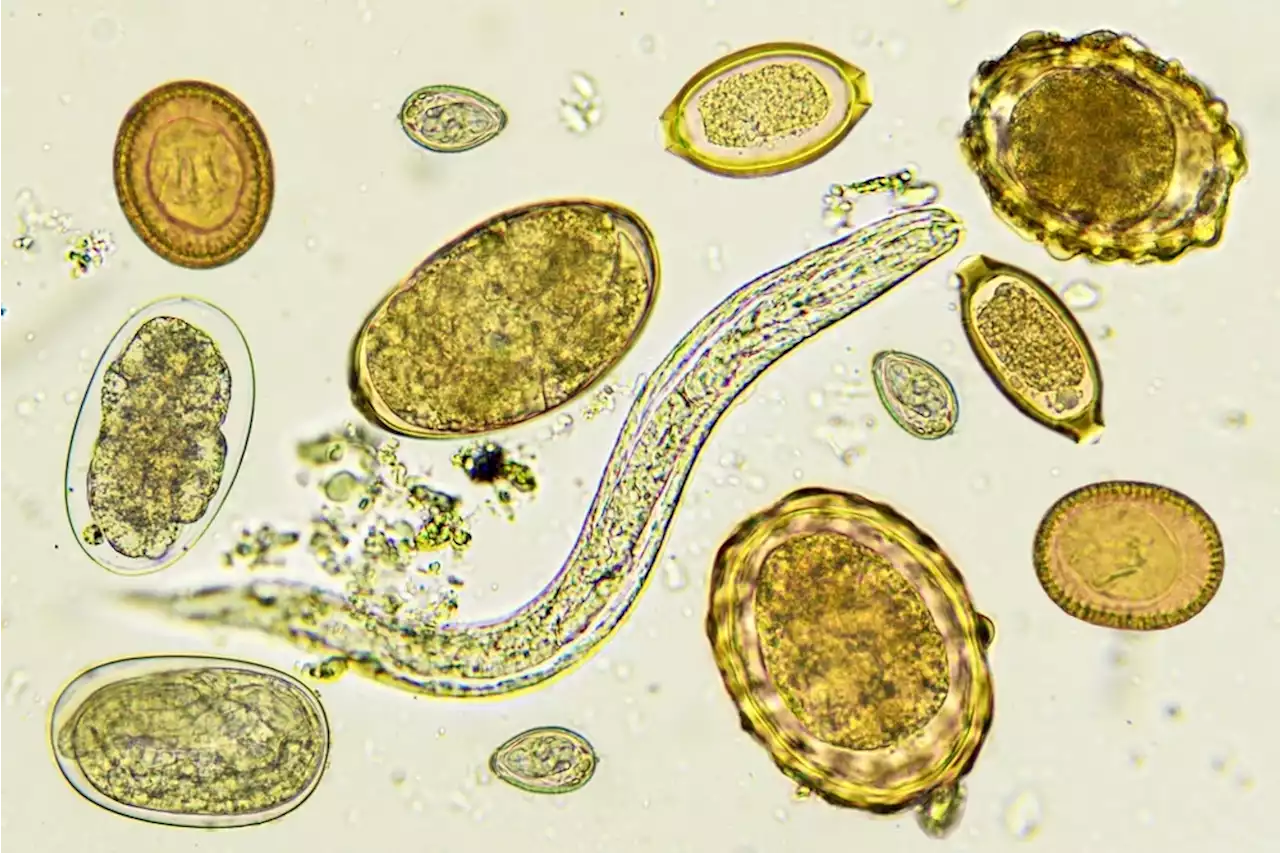 The impact of lung remodeling from prior helminth infection on SARS-CoV-2 disease pathogenesis