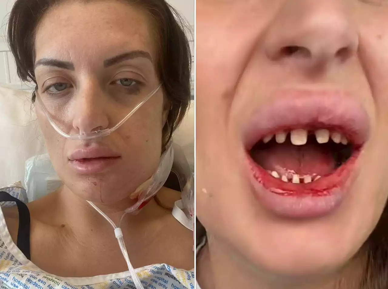 Woman who went to Turkey for dental work 'left in hospital fighting for her life'