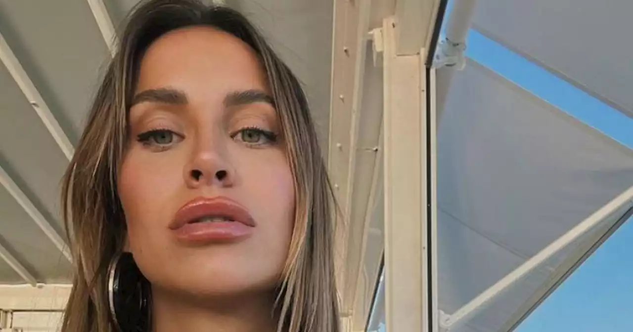 Ferne McCann's full statement as she apologises for acid attack victim comments