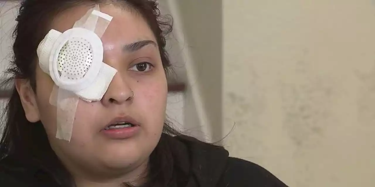 Woman loses eye defending special needs teen from bullying