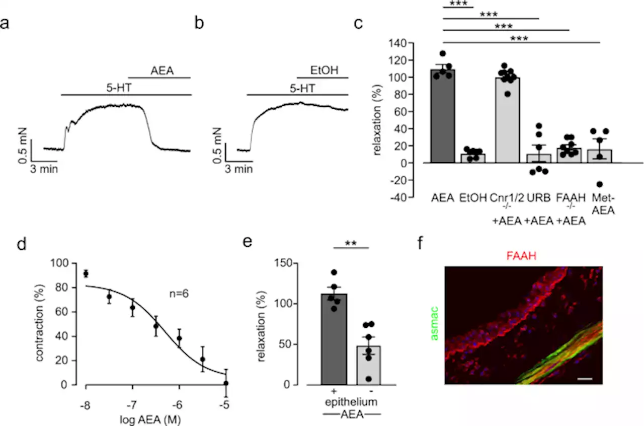 The endocannabinoid anandamide is an airway relaxant in health and disease - Nature Communications