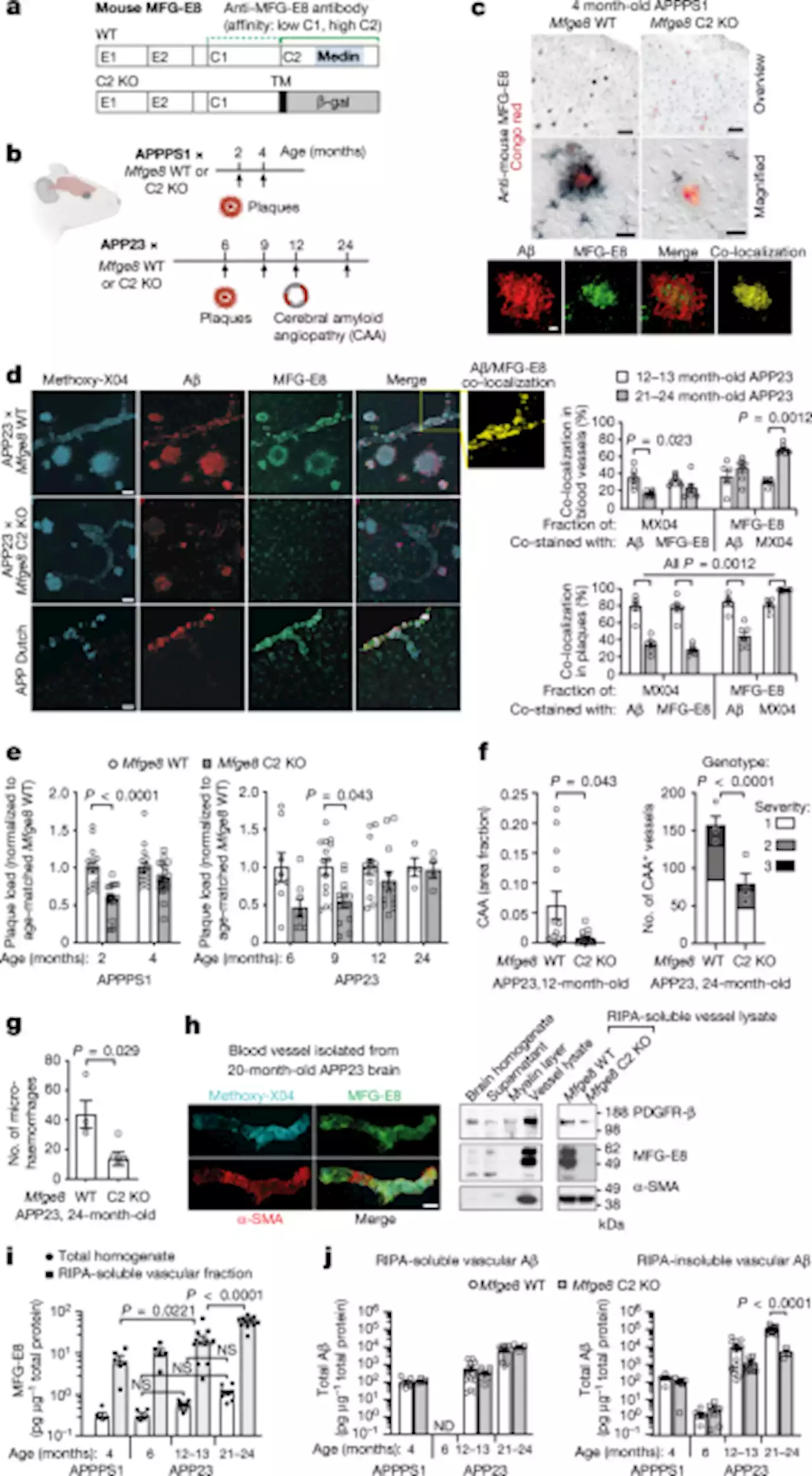 Medin co-aggregates with vascular amyloid-β in Alzheimer’s disease - Nature