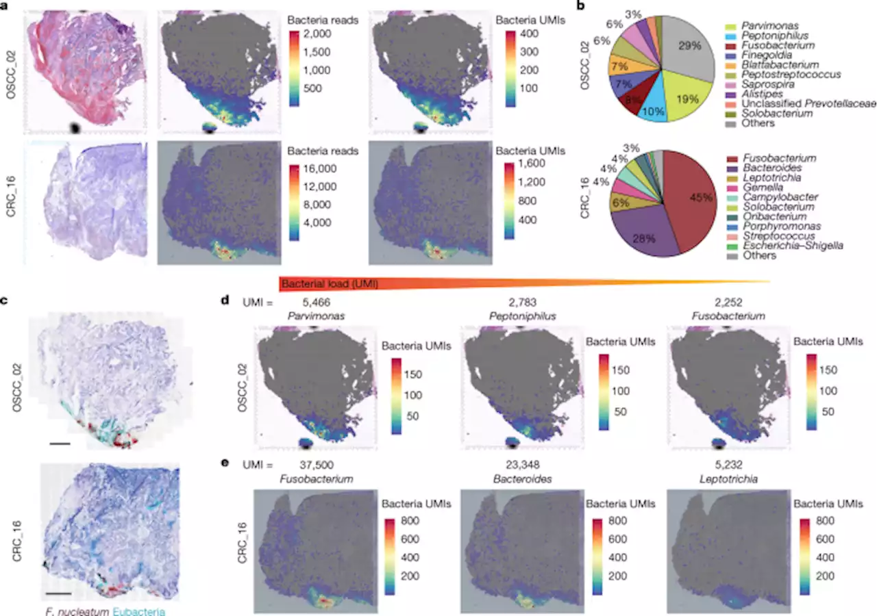 Effect of the intratumoral microbiota on spatial and cellular heterogeneity in cancer - Nature