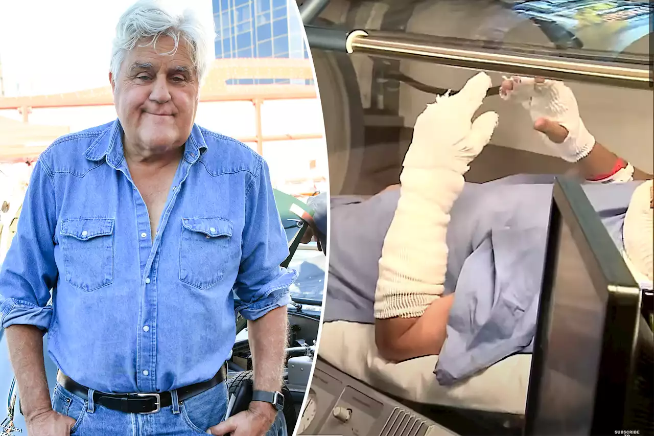 Bandaged Jay Leno seen treating third-degree burns in hyperbaric chamber