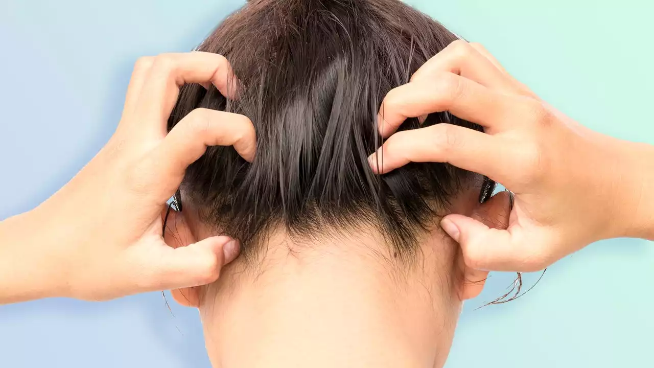 12 reasons you have an itchy scalp, plus an expert-approved guide to treating them fast