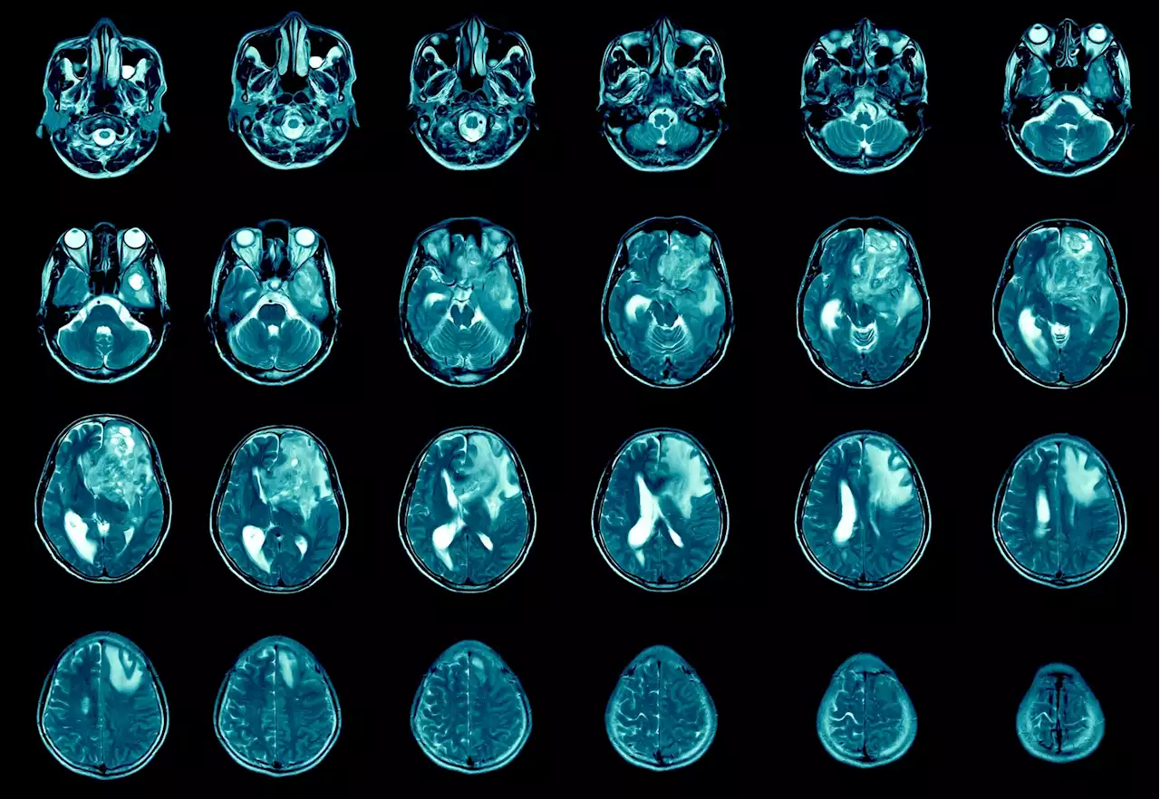 Pt(IV)-conjugated drug-delivery system shows efficacy in glioblastoma therapy