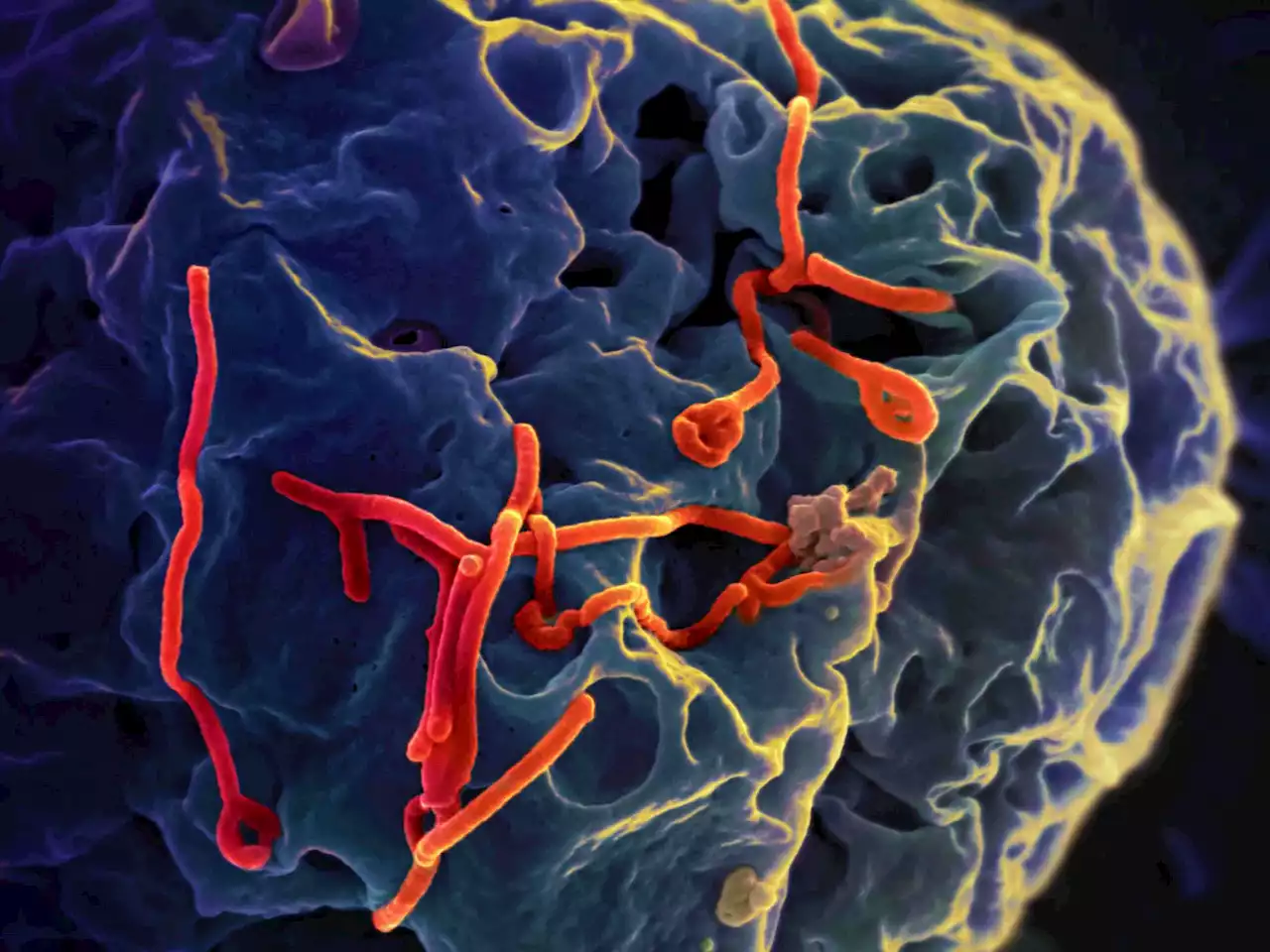 The 5 signs of killer Ebola after scare as UK patient 'show's viral signs'