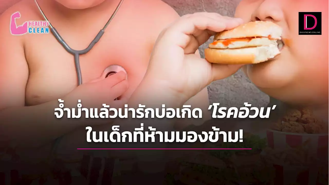 จ้ำม่ำแล้วน่ารักบ่อเกิด 'โรคอ้วน' ในเด็กที่ห้ามมองข้าม! | เดลินิวส์