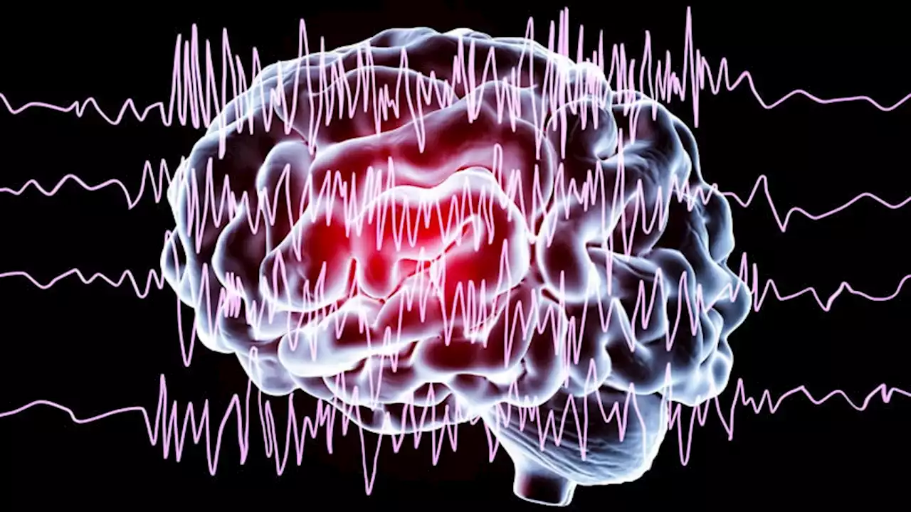 Higher Risk for Seizures After COVID vs Influenza