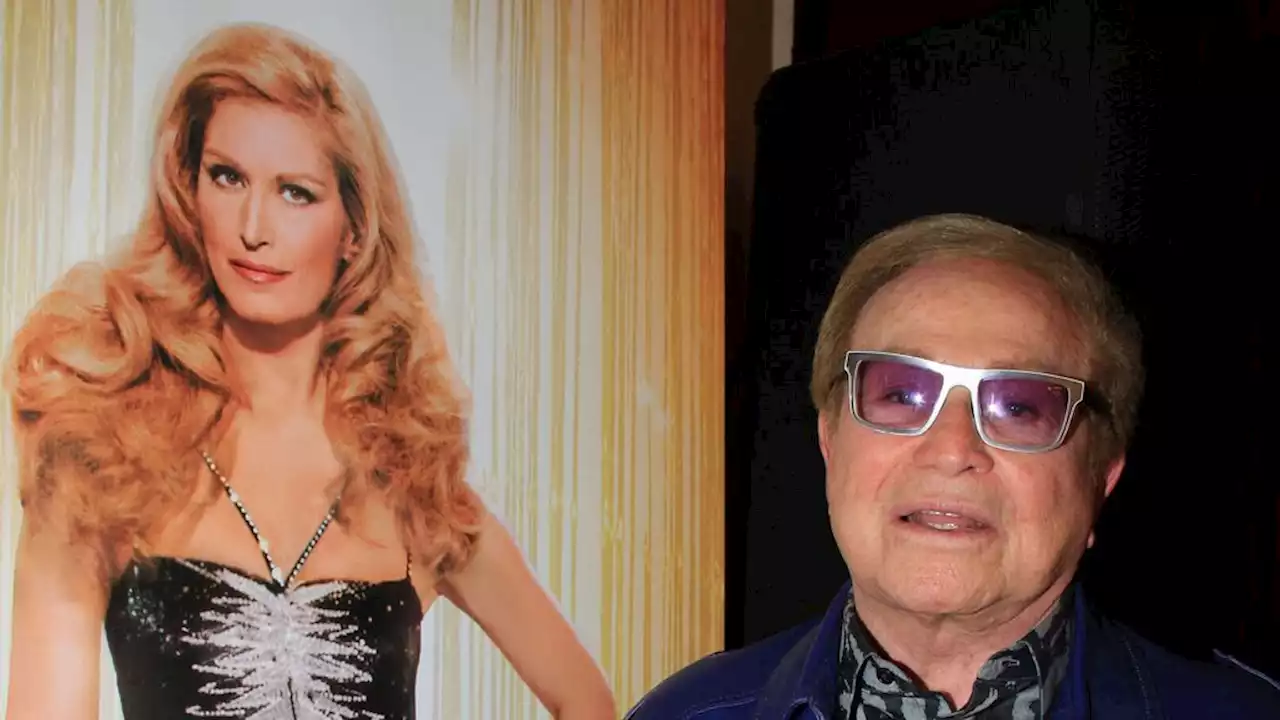 Orlando : cette imitation de sa soeur Dalida qu'il ne pardonnera jamais