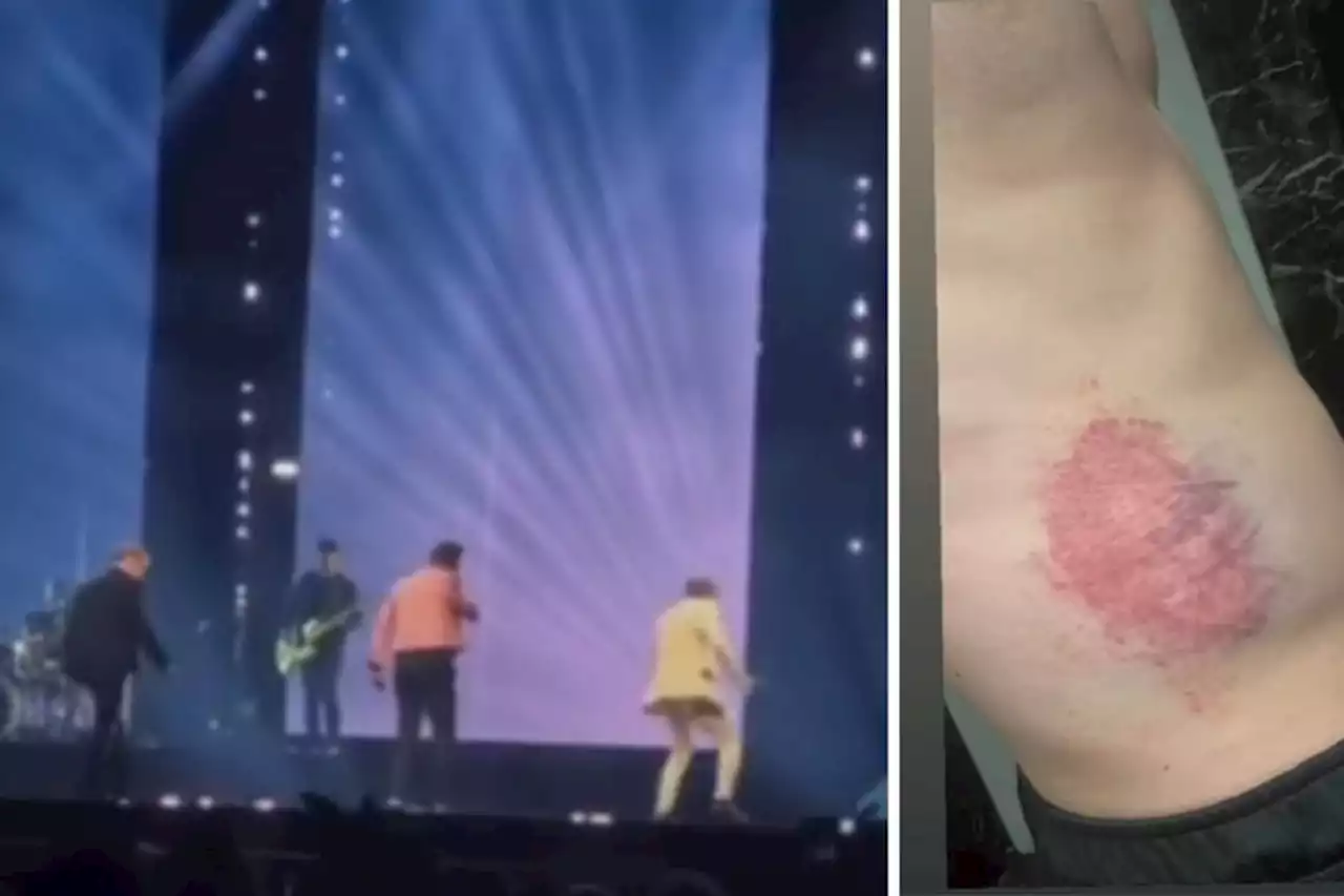 'Bit bruised' Westlife star updates fans after falling off stage in Glasgow