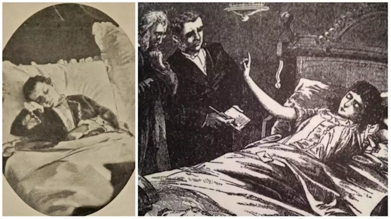 The 'Fasting Girl': A Victorian Phenomenon That Made Starvation Trendy