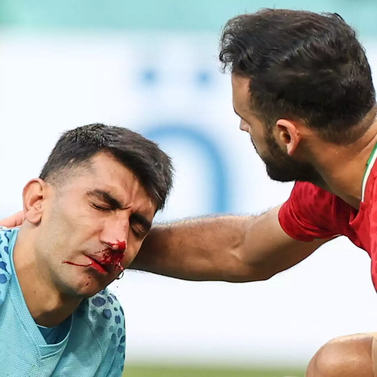 Inghilterra-Iran: infortunio al volto per Beiranvand, partita ferma per 10'