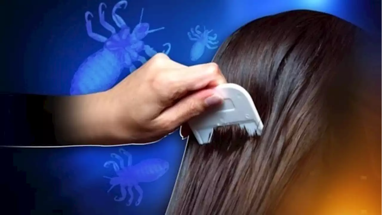 What to do if your child gets lice at school