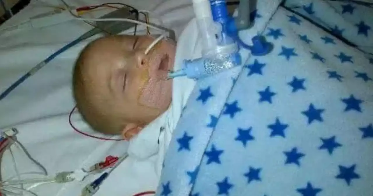 Leeds mum 'cried for days' as 'warrior' baby boy had heart op at 3 months