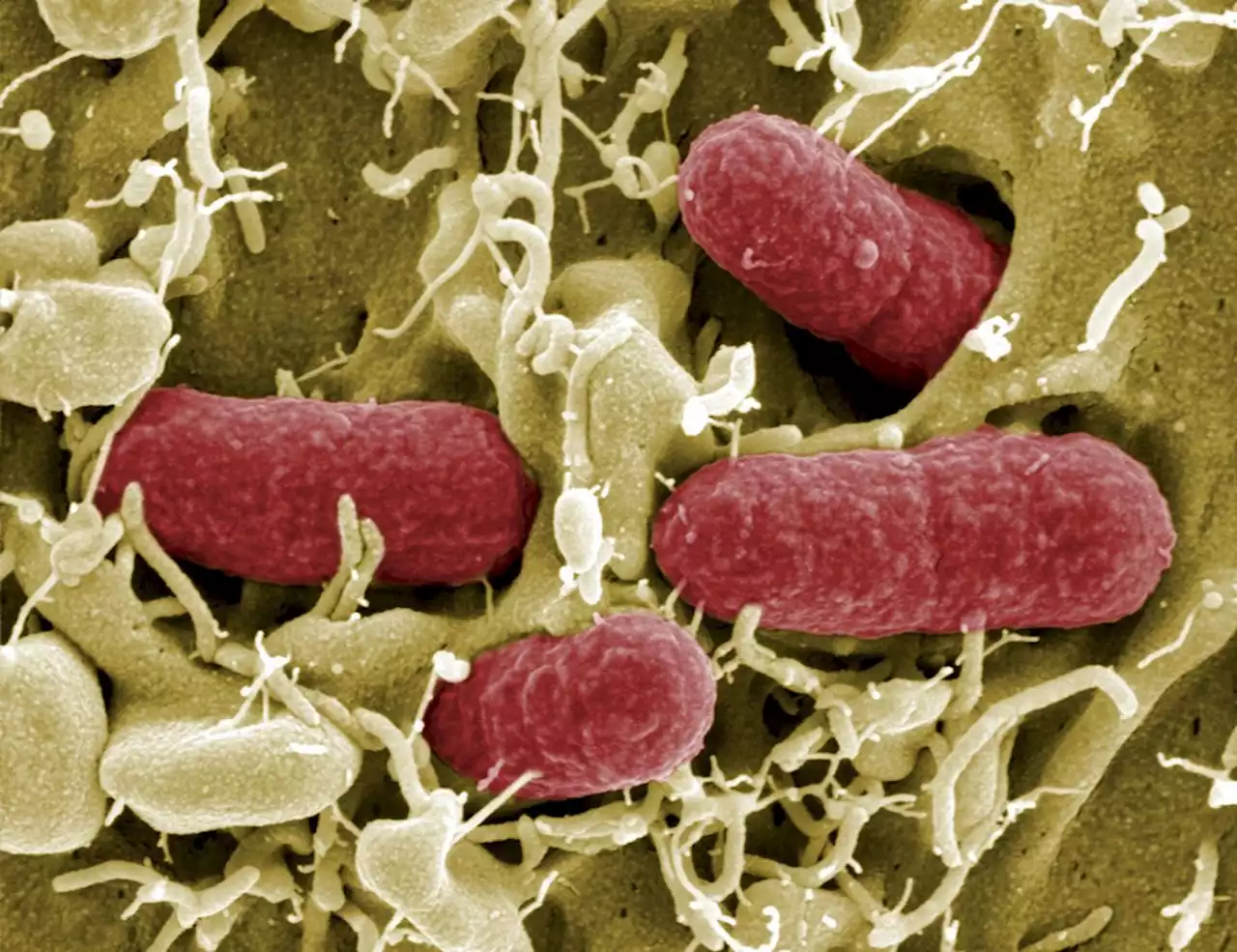 Infecções bacterianas foram a segunda causa de morte no mundo em 2019