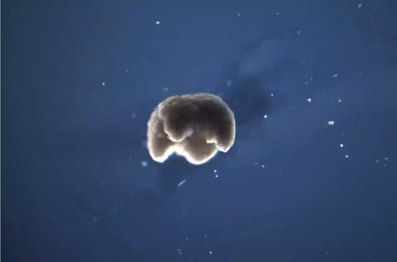 Tiny nanobots made of frog cells might prevent your next heart attack