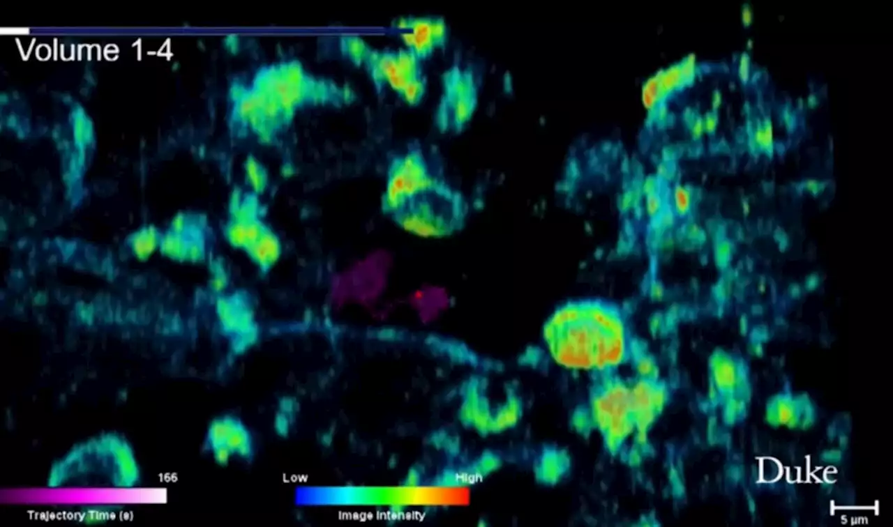 Así ataca un virus nuestro organismo en 3D | UNAM Global