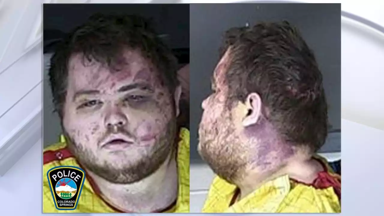 Colorado gay club shooting suspect, visibly injured by patrons, held without bail