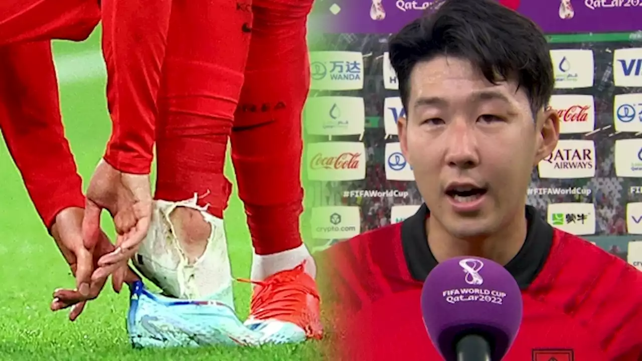 마스크 쓰고 발이 밟혀도…손흥민 '혼의 축구' BBC 선정 MVP