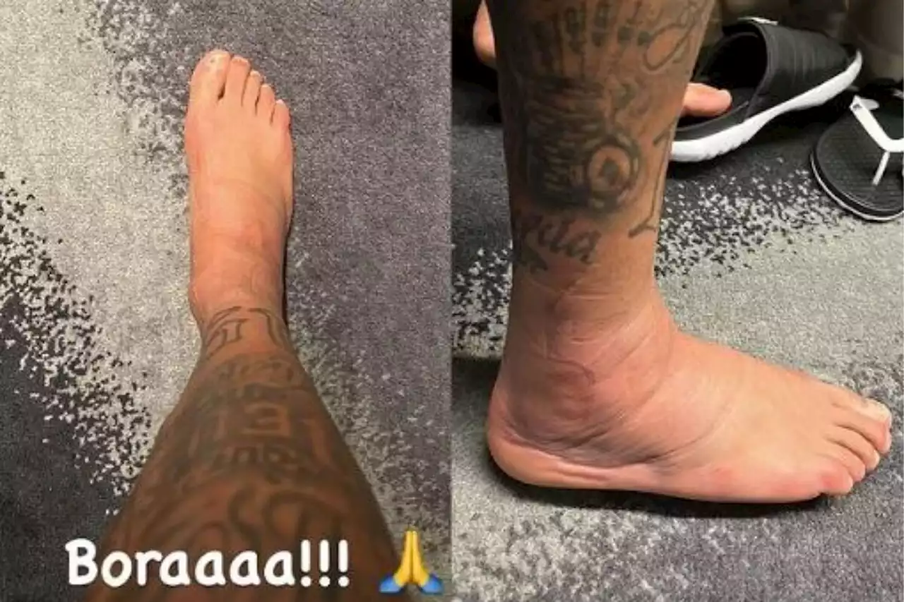 Neymar espanta a todo Brasil con una foto de su tobillo