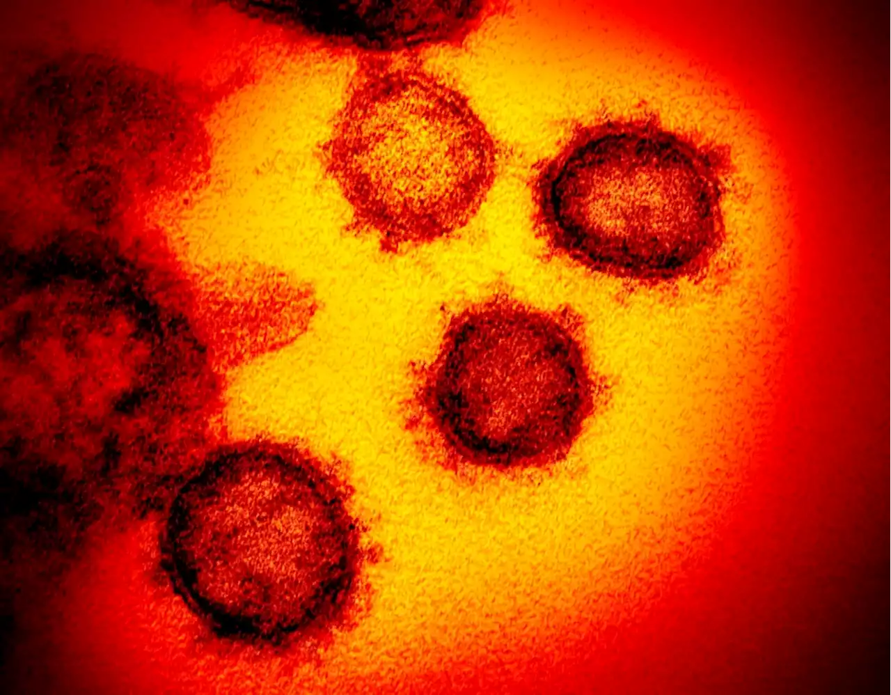 Just 1 in 20 people in the U.S. have dodged COVID infection so far, study says