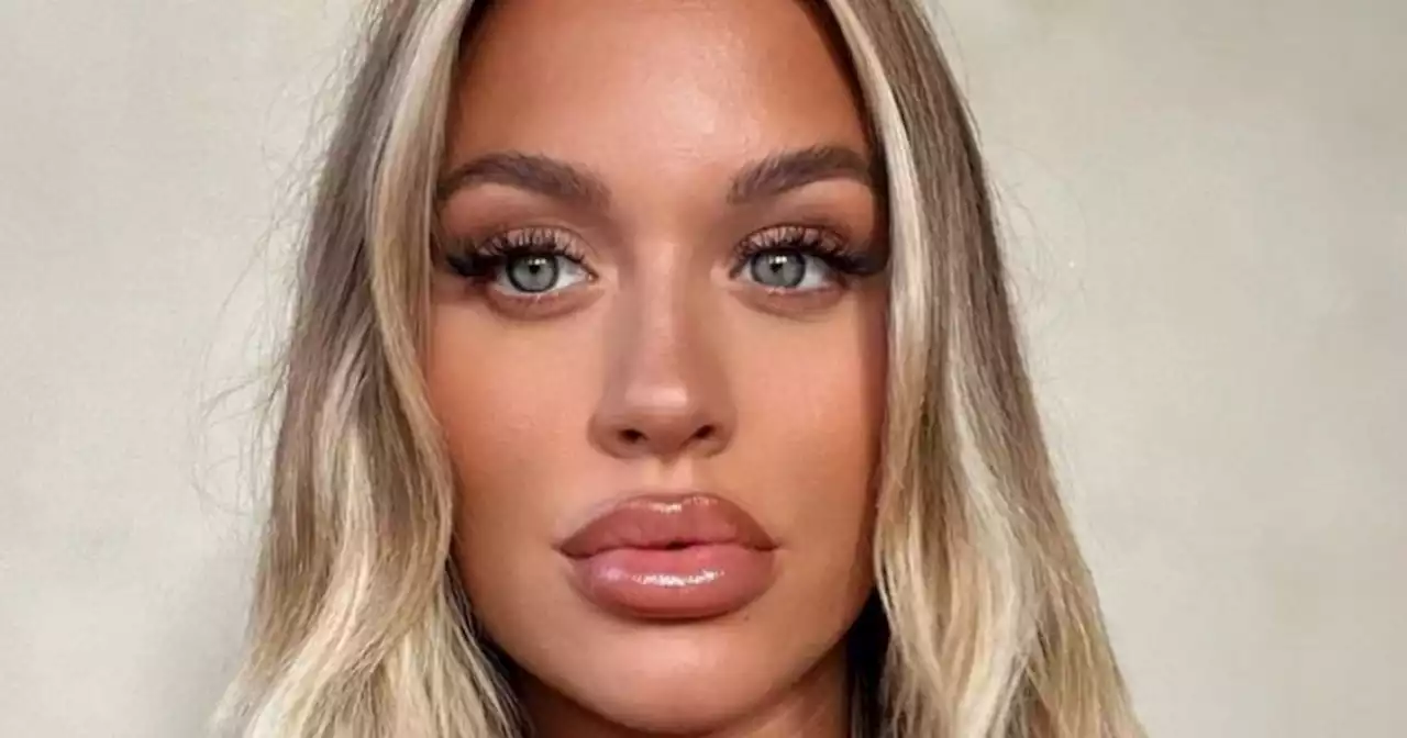 Lottie Tomlinson shows off final results of having her lip filler removed